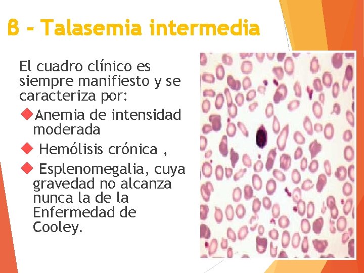 β - Talasemia intermedia El cuadro clínico es siempre manifiesto y se caracteriza por: