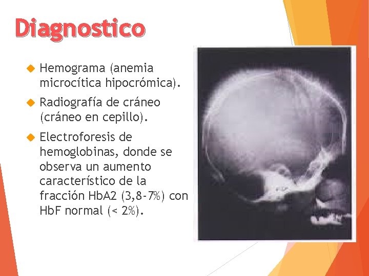 Diagnostico Hemograma (anemia microcítica hipocrómica). Radiografía de cráneo (cráneo en cepillo). Electroforesis de hemoglobinas,