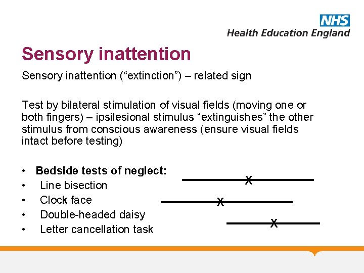 Sensory inattention (“extinction”) – related sign Test by bilateral stimulation of visual fields (moving