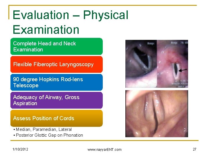 Evaluation – Physical Examination Complete Head and Neck Examination Flexible Fiberoptic Laryngoscopy 90 degree