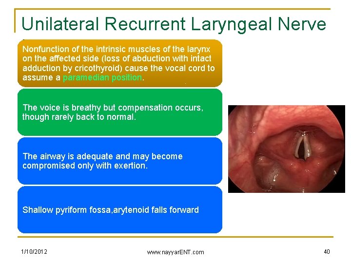 Unilateral Recurrent Laryngeal Nerve Nonfunction of the intrinsic muscles of the larynx Injury on