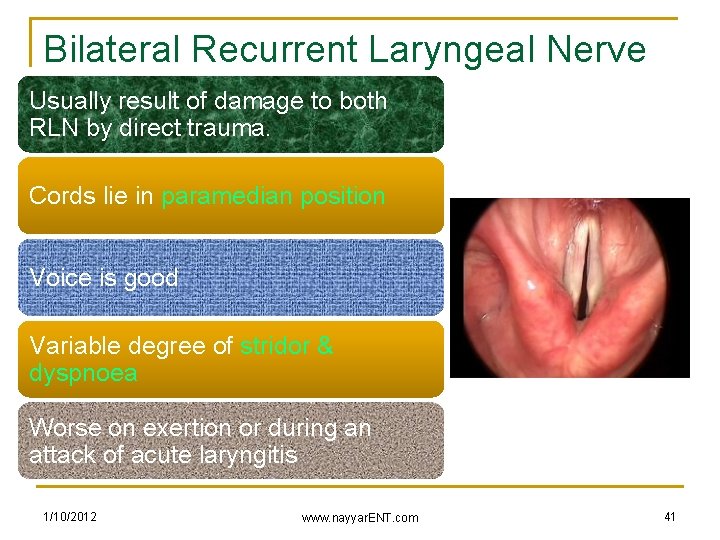 Bilateral Recurrent Laryngeal Nerve Injuryresult of damage to both Usually RLN by direct trauma.