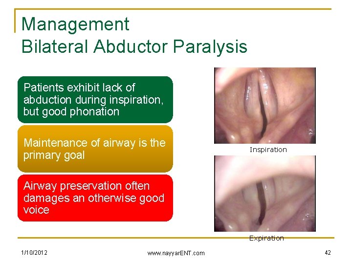 Management Bilateral Abductor Paralysis Patients exhibit lack of abduction during inspiration, but good phonation