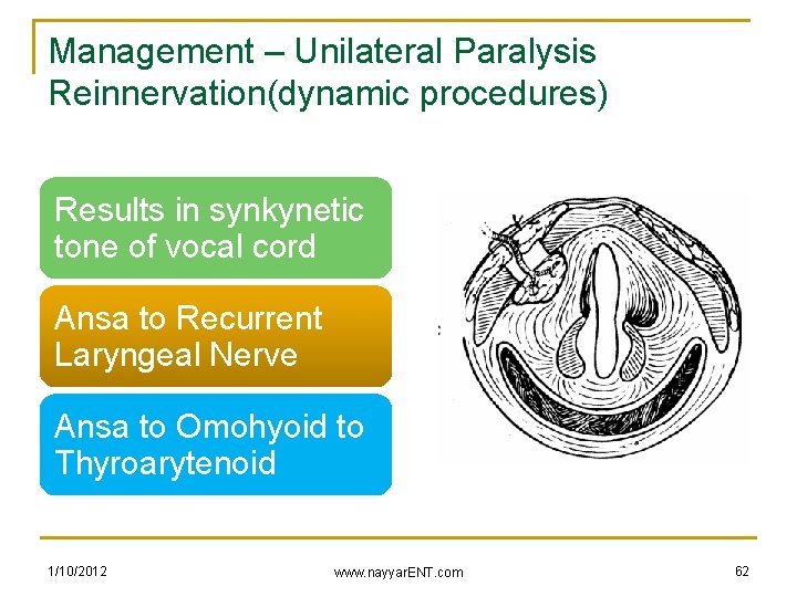 Management – Unilateral Paralysis Reinnervation(dynamic procedures) Results in synkynetic tone of vocal cord Ansa