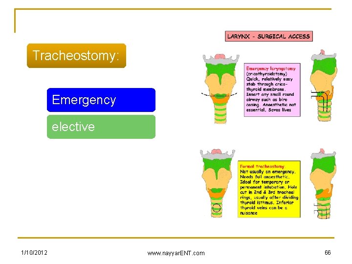 Tracheostomy: Emergency elective 1/10/2012 www. nayyar. ENT. com 66 