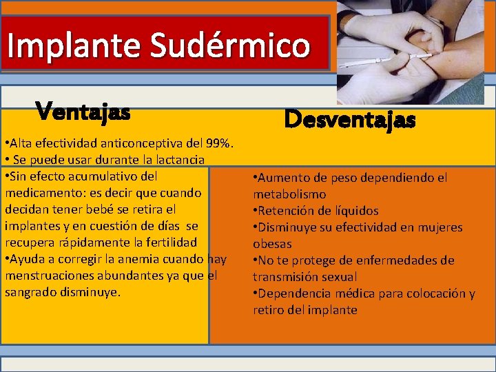 Implante Sudérmico Ventajas • Alta efectividad anticonceptiva del 99%. • Se puede usar durante