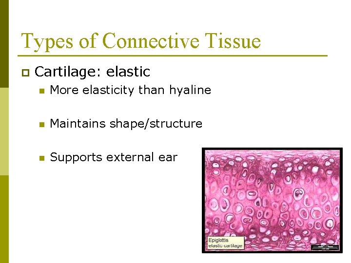 Types of Connective Tissue p Cartilage: elastic n More elasticity than hyaline n Maintains