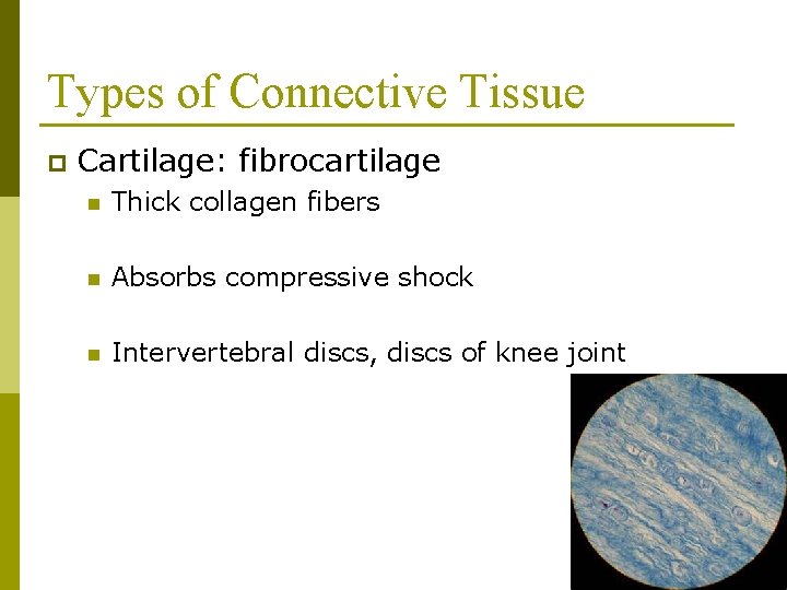 Types of Connective Tissue p Cartilage: fibrocartilage n Thick collagen fibers n Absorbs compressive