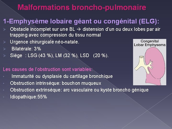 Malformations broncho-pulmonaire 1 -Emphysème lobaire géant ou congénital (ELG): Obstacle incomplet sur une BL