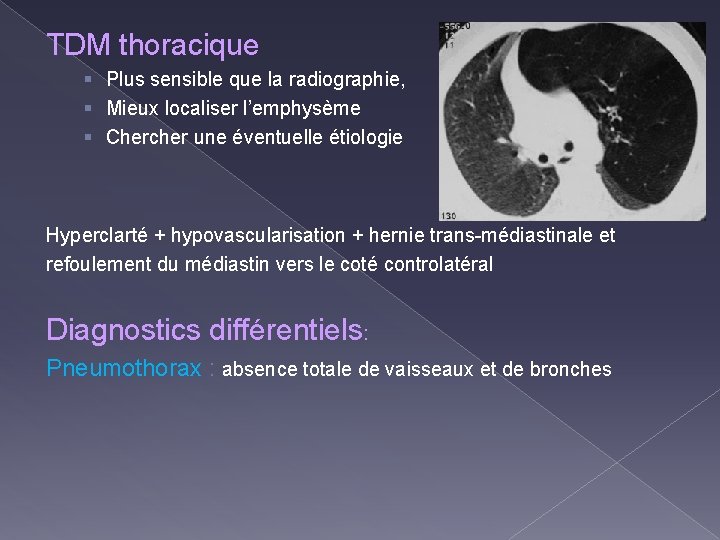 TDM thoracique § Plus sensible que la radiographie, § Mieux localiser l’emphysème § Chercher