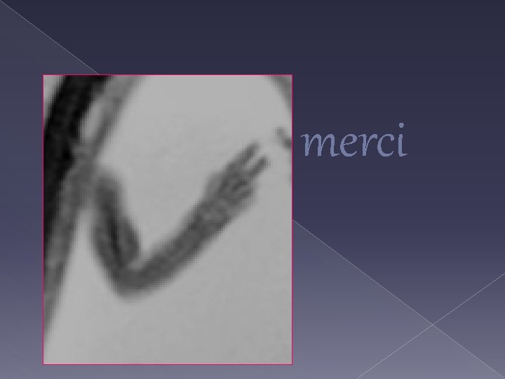 merci 