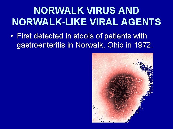 NORWALK VIRUS AND NORWALK-LIKE VIRAL AGENTS • First detected in stools of patients with