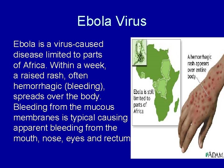 Ebola Virus Ebola is a virus-caused disease limited to parts of Africa. Within a