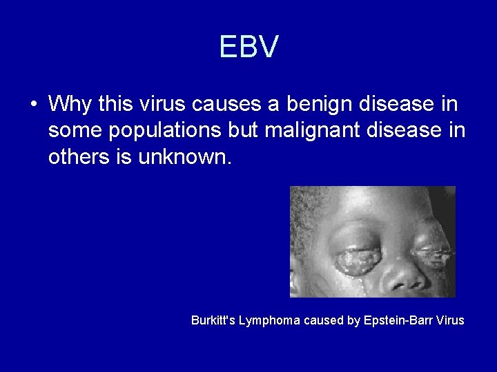 EBV • Why this virus causes a benign disease in some populations but malignant