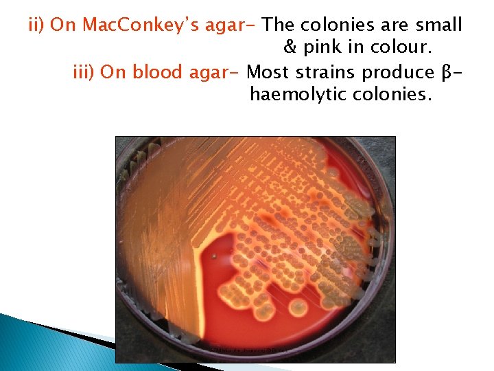 ii) On Mac. Conkey’s agar- The colonies are small & pink in colour. iii)