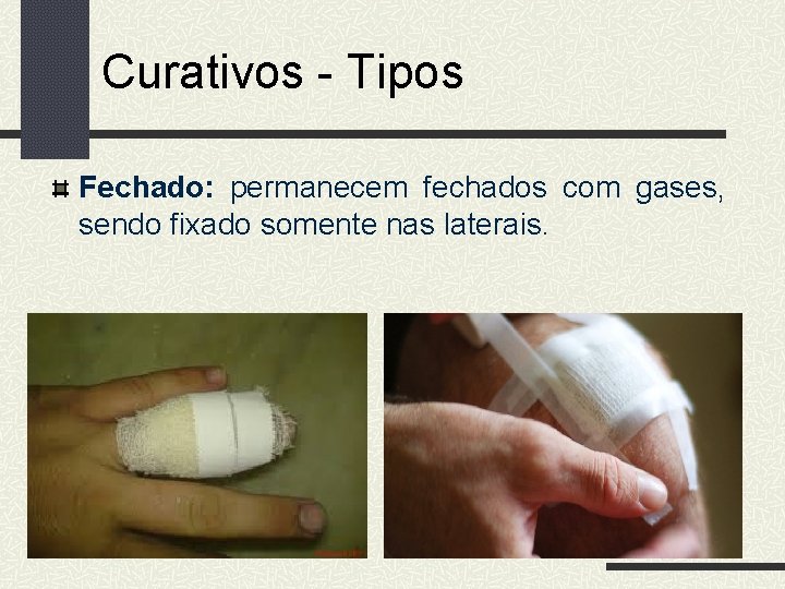 Curativos - Tipos Fechado: permanecem fechados com gases, sendo fixado somente nas laterais. 