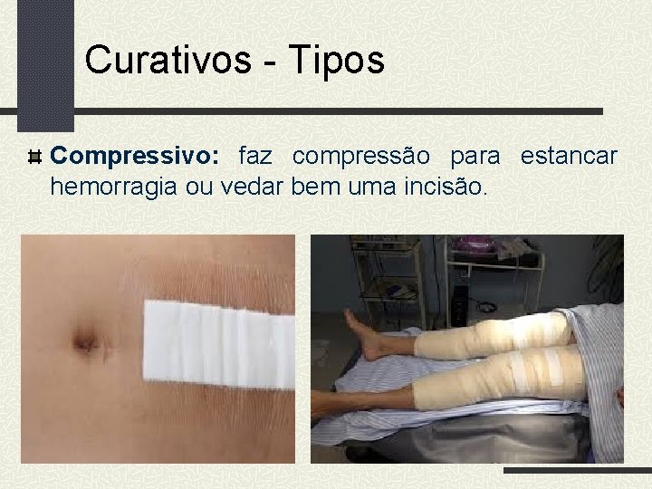 Curativos - Tipos Compressivo: faz compressão para estancar hemorragia ou vedar bem uma incisão.