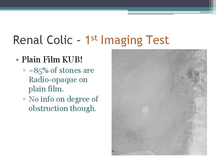 Renal Colic – 1 st Imaging Test • Plain Film KUB! ▫ ~85% of