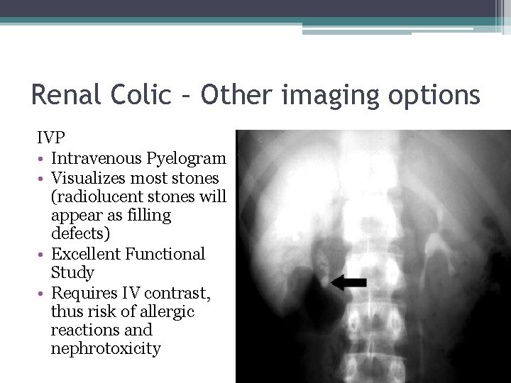 Renal Colic – Other imaging options IVP • Intravenous Pyelogram • Visualizes most stones