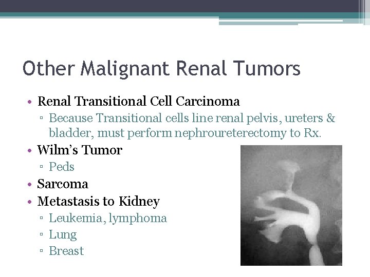Other Malignant Renal Tumors • Renal Transitional Cell Carcinoma ▫ Because Transitional cells line