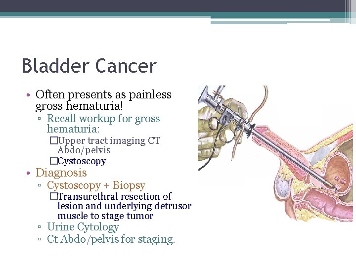 Bladder Cancer • Often presents as painless gross hematuria! ▫ Recall workup for gross