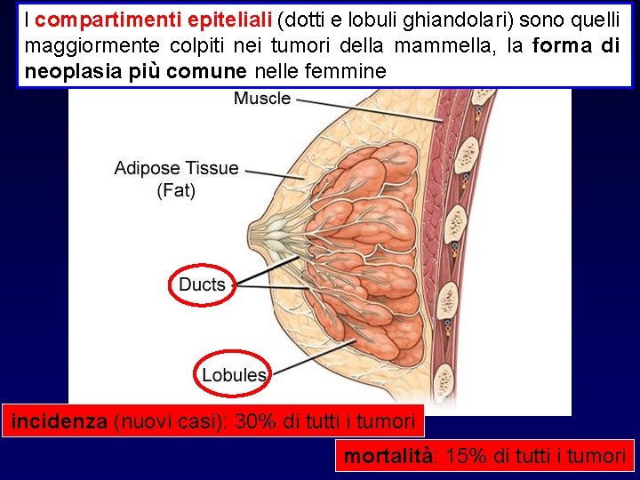 I compartimenti epiteliali (dotti e lobuli ghiandolari) sono quelli maggiormente colpiti nei tumori della