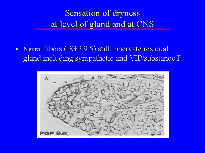 Sensation of dryness at level of gland at CNS • Neural fibers (PGP 9.