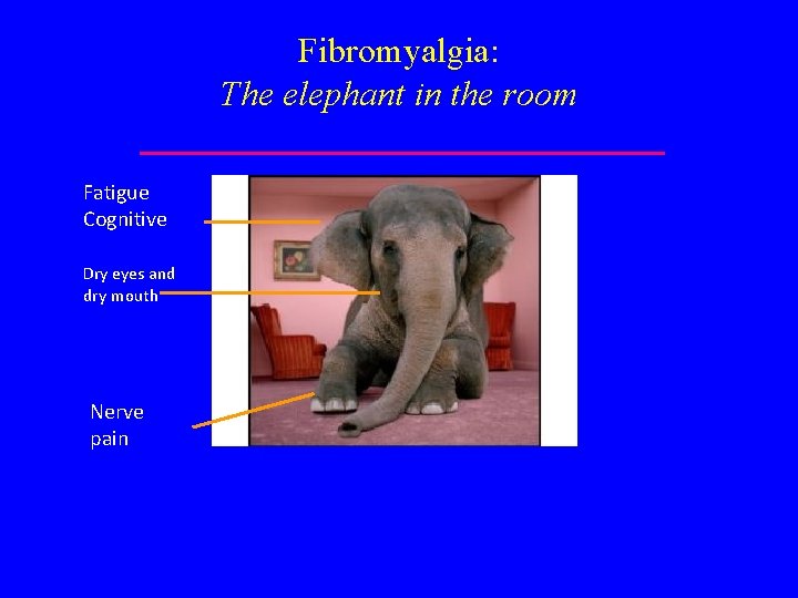Fibromyalgia: The elephant in the room Fatigue Cognitive Dry eyes and dry mouth Nerve