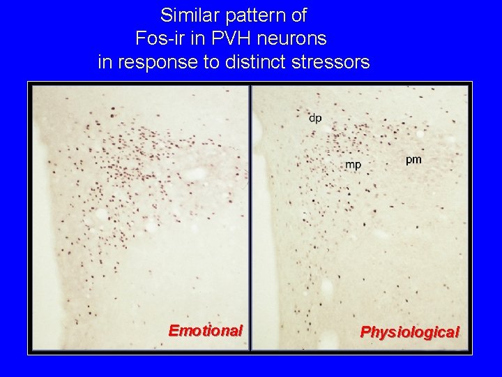 Similar pattern of Fos-ir in PVH neurons in response to distinct stressors Emotional Physiological