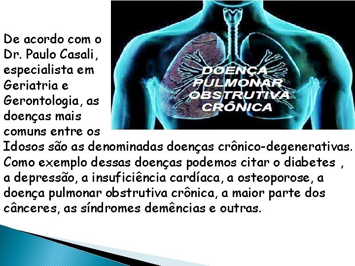 De acordo com o Dr. Paulo Casali, especialista em Geriatria e Gerontologia, as doenças
