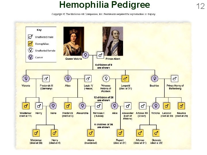 Hemophilia Pedigree 12 