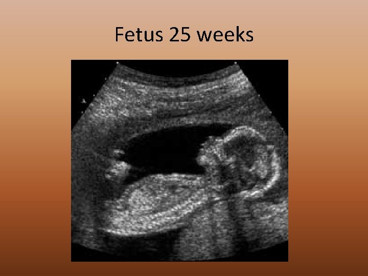 Fetus 25 weeks 