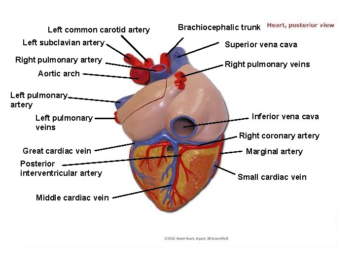 Left common carotid artery Left subclavian artery Right pulmonary artery Brachiocephalic trunk Superior vena