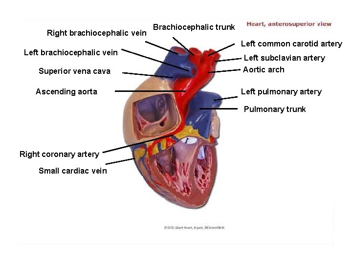 Right brachiocephalic vein Brachiocephalic trunk Left common carotid artery Left brachiocephalic vein Superior vena
