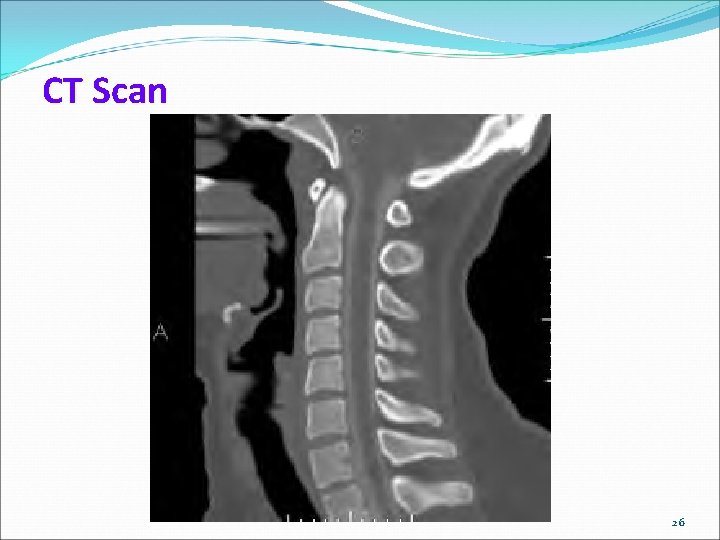 CT Scan 26 