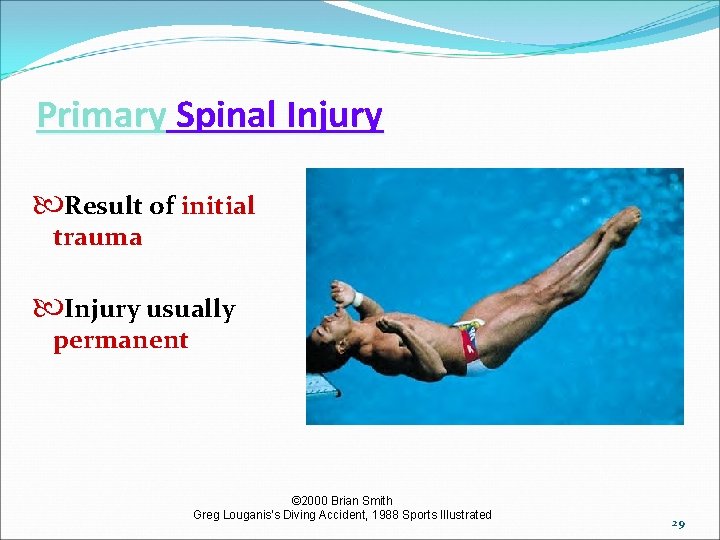 Primary Spinal Injury Result of initial trauma Injury usually permanent © 2000 Brian Smith