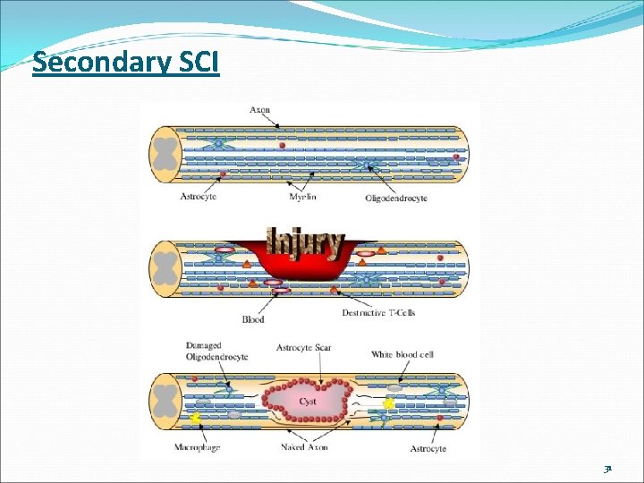 Secondary SCI 31 