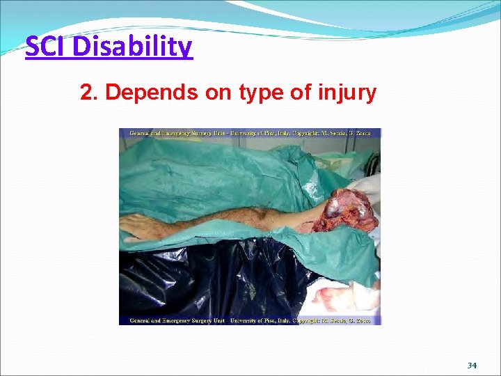 SCI Disability 2. Depends on type of injury 34 