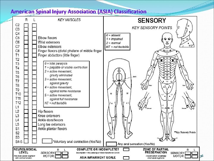 American Spinal Injury Association (ASIA) Classification 36 