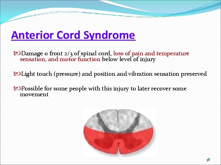 Anterior Cord Syndrome Damage o front 2/3 of spinal cord, loss of pain and