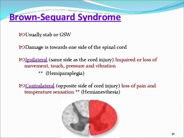 Brown-Sequard Syndrome Usually stab or GSW Damage is towards one side of the spinal