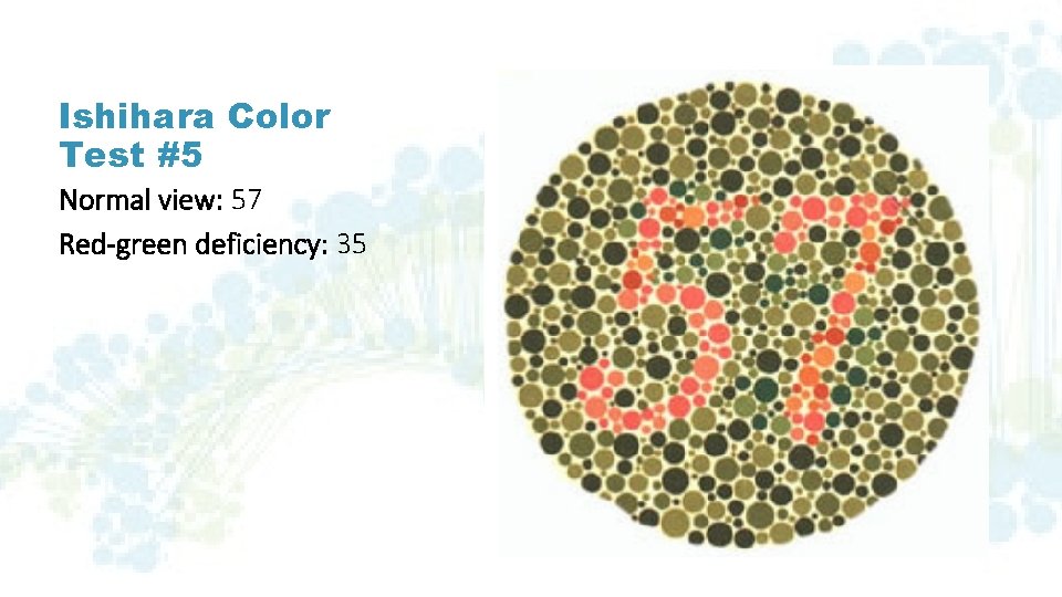 Ishihara Color Test #5 Normal view: 57 Red-green deficiency: 35 