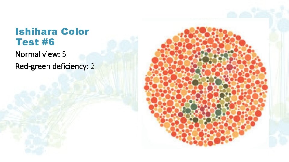 Ishihara Color Test #6 Normal view: 5 Red-green deficiency: 2 