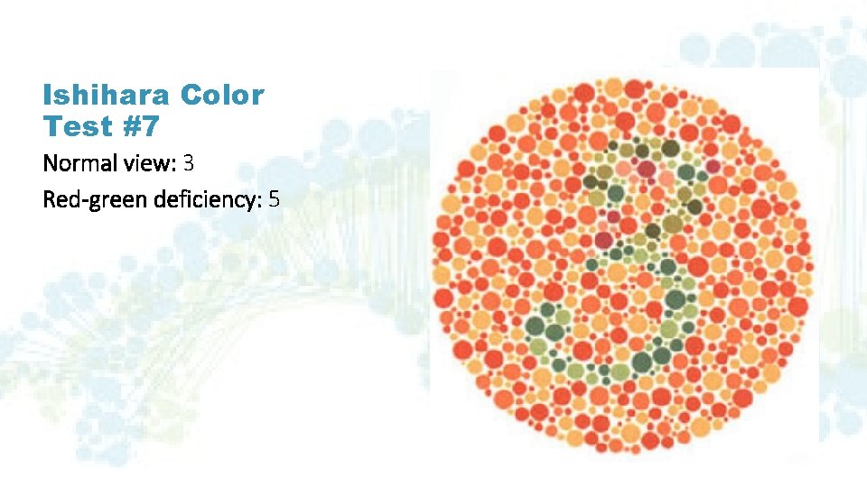 Ishihara Color Test #7 Normal view: 3 Red-green deficiency: 5 