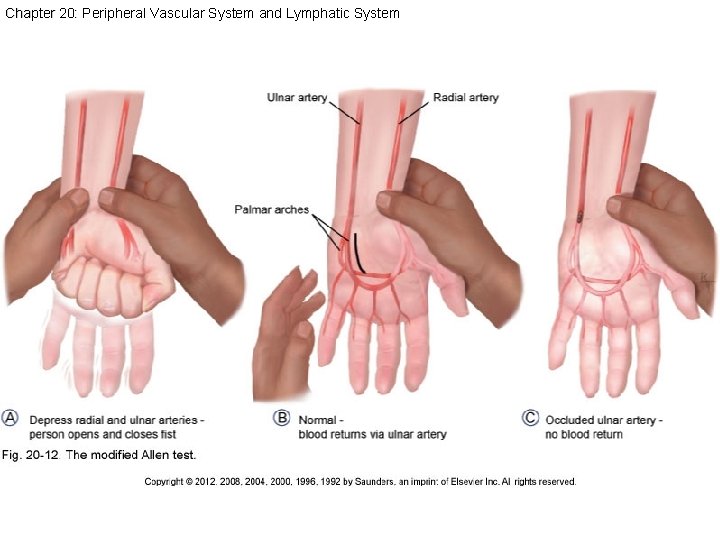 Chapter 20: Peripheral Vascular System and Lymphatic System 