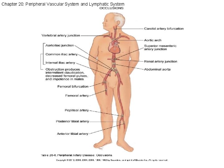 Chapter 20: Peripheral Vascular System and Lymphatic System 