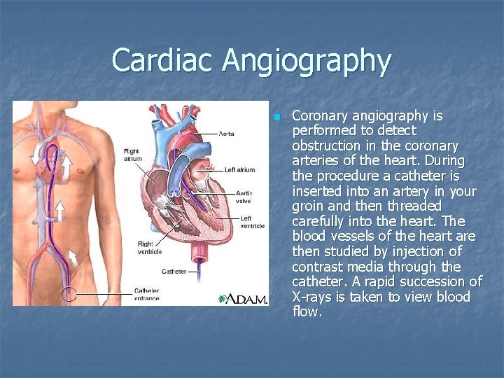 Cardiac Angiography n Coronary angiography is performed to detect obstruction in the coronary arteries