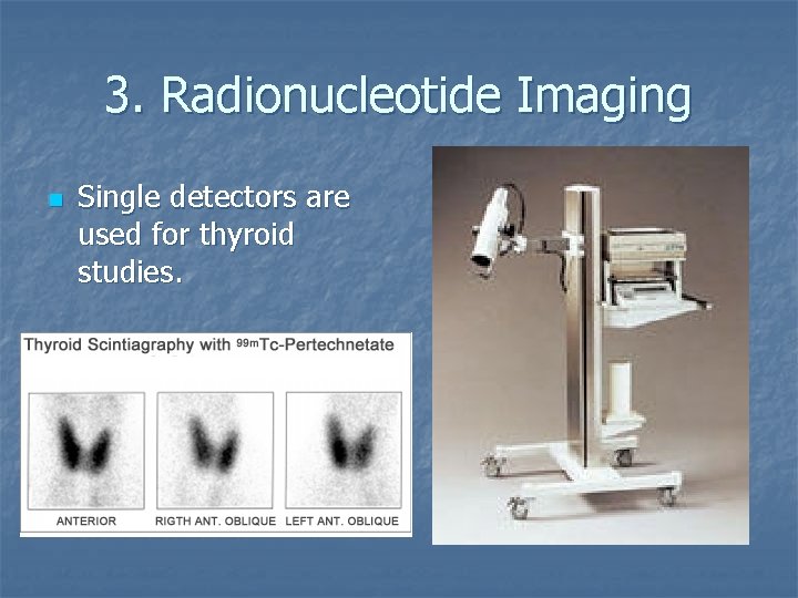 3. Radionucleotide Imaging n Single detectors are used for thyroid studies. 