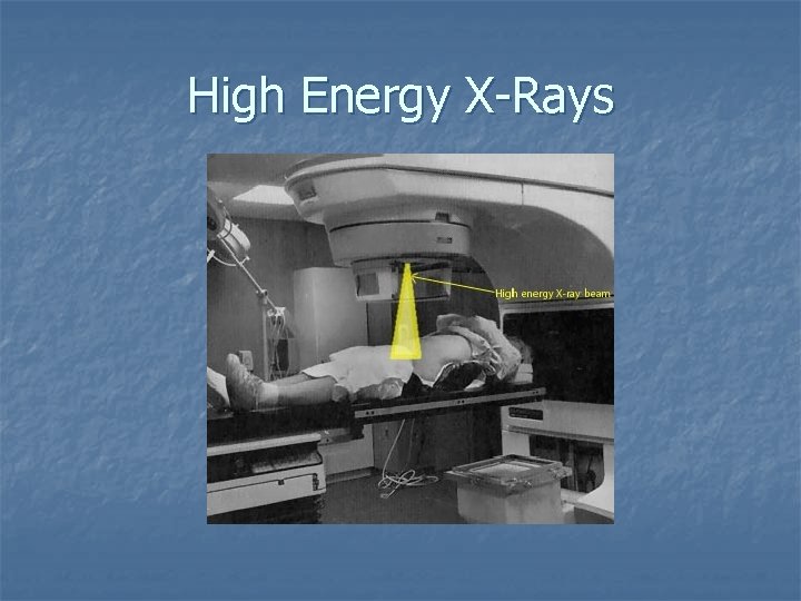 High Energy X-Rays 