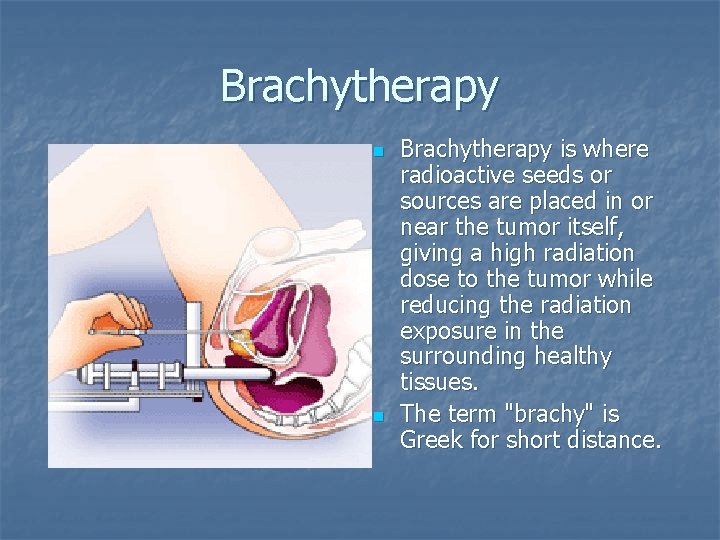 Brachytherapy n n Brachytherapy is where radioactive seeds or sources are placed in or